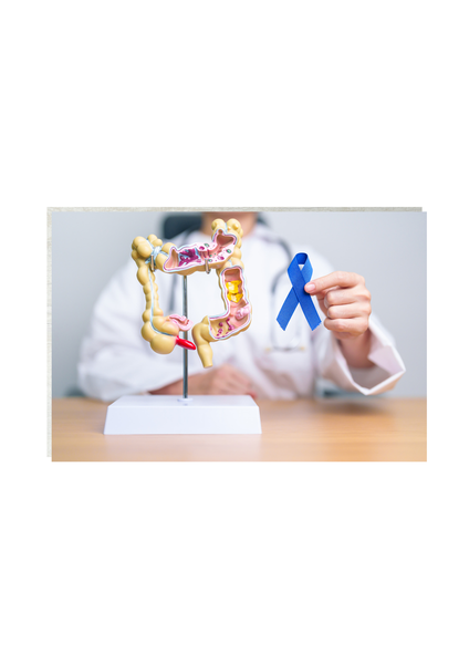 Prévention du cancer colo-rectal