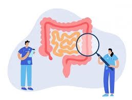 Dépistage du cancer colo-rectal